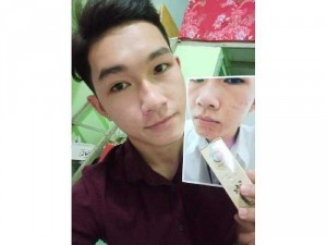 Hoàng Thiên Sâm Trị Tất Cả Mụn
