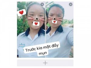 Sản phẩm trị mụn tốt nhất hiện nay