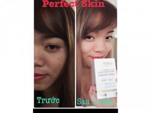 Mỹ phẩm cao cấp độc quyền damode viên uống trắng da Perfect Skin