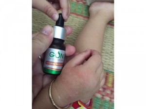 Serum dưỡng da/ trị mụn/ nám GON