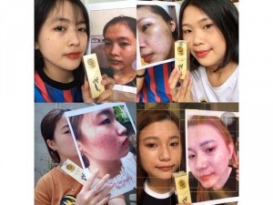 COMBO TÁI TẠO SIÊU CẤP HOÀNG THIÊN SÂM