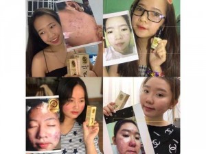 COMBO TÁI TẠO SIÊU CẤP HOÀNG THIÊN SÂM