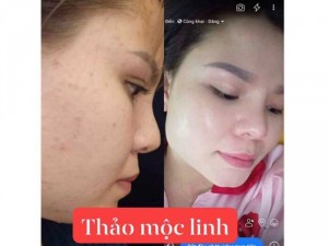 Đông Y Thảo Mộc Linh