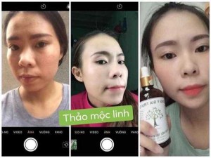 Đông Y Thảo Mộc Linh