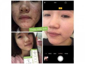 Đông Y Thảo Mộc Linh