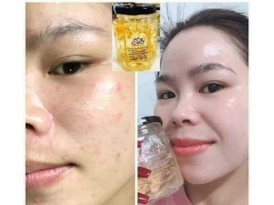 Nạ yến
