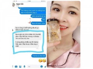 Nạ yến
