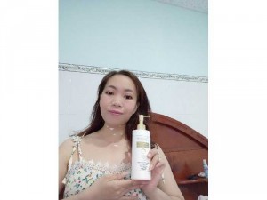 Truyền trắng chân lông