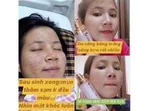 Combo ủ trắng+ face cây trắng
