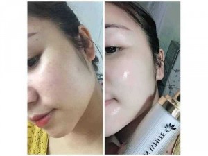 Ủ trắng da