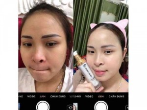 Ủ face