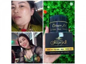 Kem Face trị mụn - thâm - nám - trắng da - chống nắng