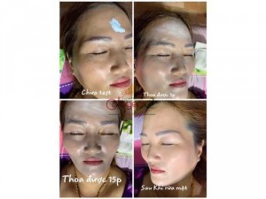 Mặt nạ thải độc chì tảo biển