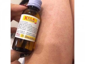Kela lotion trị viêm chân lông