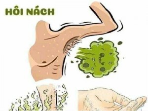 Thuốc đặc trị hôi nách