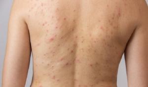 MUỐI TĂM BODY LAVENDER ORGANIC