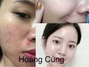Bộ kem hoàng cung hồng (danxuenilan)