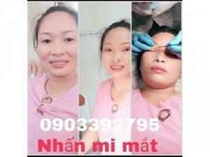 Bấm mí mắt tự nhiên chuẩn hot gril