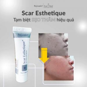 KEM TRỊ SẸO THÂM LÕM RỖ SCAR HEAL MỸ CHÍNH HÃNG