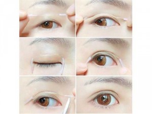2 Vỉ chỉ kích mí 104 sợi