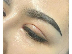 Bấm mí mắt giá bao nhiêu tiền