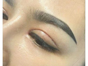 Bấm mí mắt giá bao nhiêu tiền