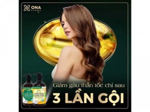 Dầu gội xả gừng dừa hỗ trợ trị gàu, ngứa da đầu hiệu quả