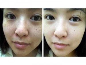 Sản phẩm colagen cham sóc sắc đẹp