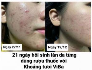 Mua quà tặng 8/3 Mỹ phẩm Skincare tự nhiên Khoáng Tươi Viba