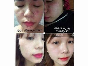 Tinh chất sắc dược nám