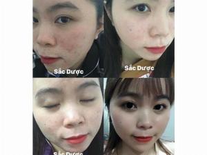 Tinh chất sắc dược nám