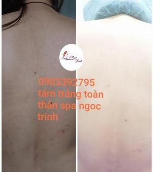Tắm Trắng Toàn Thân Tại Spa
