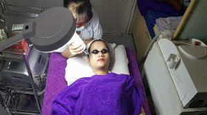 Trị nám tàn nhang bằng laser