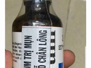Serum Đức Điều Trị Mụn và các vấn đề Da