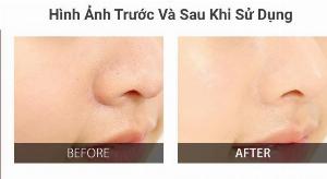 Thanh lăn mụn Red Peel Clear Stick