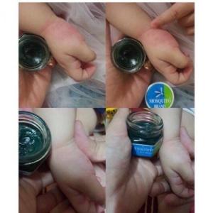 Dầu thoa trị muỗi đốt Mosquito Balm Thái Lan cho bé