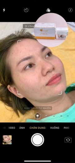 Kem Nám .Đốm Nâu Sắc Dược