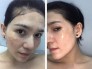 Kem trị mụn, mỹ phẩm hỗ trợ trị mụn, cách trị mụn hiệu quả cho da khô, da dầu, da nhờn, da nhạy cảm